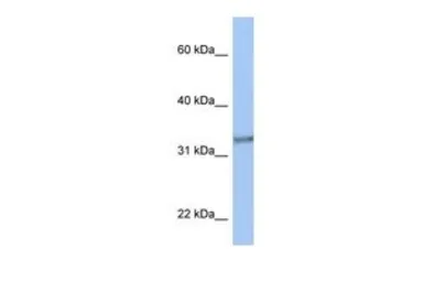 Anti-ACBD4 antibody, N-term used in Western Blot (WB). GTX45976