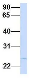 Anti-PRRG3 antibody, N-term used in Western Blot (WB). GTX45989