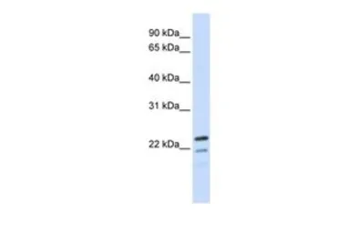 Anti-REEP1 antibody, Internal used in Western Blot (WB). GTX45998