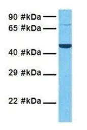 Anti-PORCN antibody, N-term used in Western Blot (WB). GTX46000