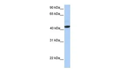 Anti-EDAR antibody, Internal used in Western Blot (WB). GTX46019