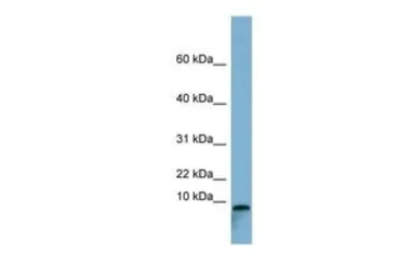 Anti-TCTA antibody, Internal used in Western Blot (WB). GTX46020