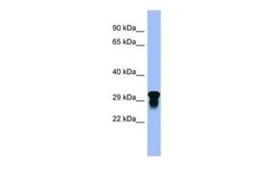 Anti-GI24 antibody, N-term used in Western Blot (WB). GTX46021