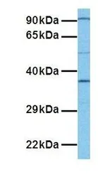Anti-TNMD antibody, Internal used in Western Blot (WB). GTX46022