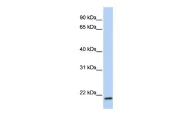 Anti-TMEM35 antibody, C-term used in Western Blot (WB). GTX46026