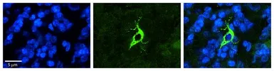 Anti-TXNDC13 antibody, C-term used in IHC (Paraffin sections) (IHC-P). GTX46032