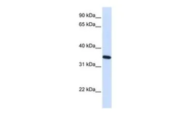Anti-RTN1 antibody, N-term used in Western Blot (WB). GTX46034