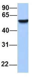 Anti-SEMA6D antibody, N-term used in Western Blot (WB). GTX46039