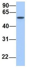 Anti-SEMA6D antibody, N-term used in Western Blot (WB). GTX46039