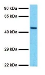Anti-SOX5 antibody, C-term used in Western Blot (WB). GTX46041