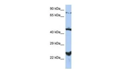 Anti-MRS2L antibody, Internal used in Western Blot (WB). GTX46048