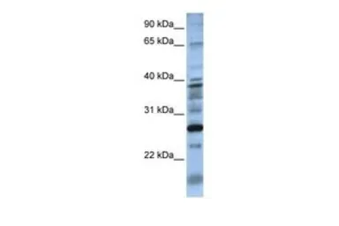 Anti-DOLPP1 antibody, N-term used in Western Blot (WB). GTX46054
