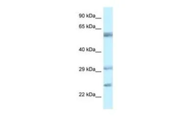 Anti-FLJ20674 antibody, N-term used in Western Blot (WB). GTX46070