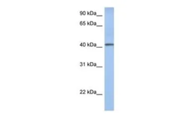 Anti-YIPF1 antibody, Internal used in Western Blot (WB). GTX46075