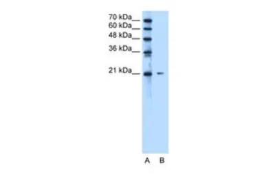 Anti-C20ORF24 antibody, N-term used in Western Blot (WB). GTX46085