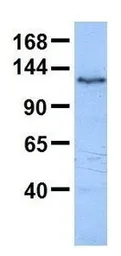Anti-TEX2 antibody, N-term used in Western Blot (WB). GTX46091