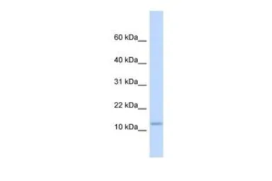 Anti-C9ORF46 antibody, Internal used in Western Blot (WB). GTX46093