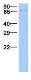 Anti-RABGGTA antibody, N-term used in Western Blot (WB). GTX46117