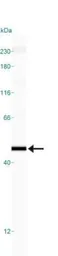Anti-p73 antibody [5B429] used in Western Blot (WB). GTX46123