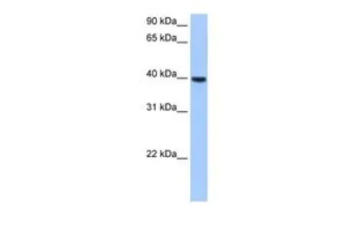 Anti-ST6GALNAC4 antibody, Internal used in Western Blot (WB). GTX46125