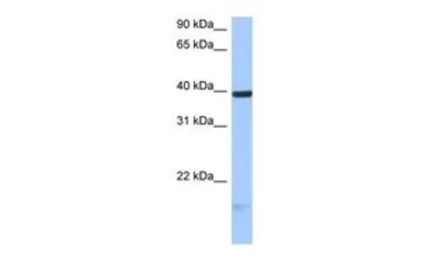 Anti-HS3ST5 antibody, C-term used in Western Blot (WB). GTX46133