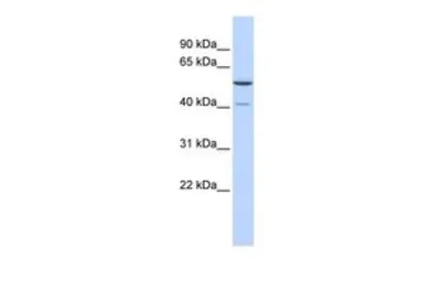 Anti-METT5D1 antibody, N-term used in Western Blot (WB). GTX46136