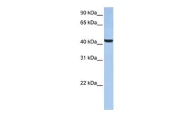 Anti-B3GNT7 antibody, N-term used in Western Blot (WB). GTX46142