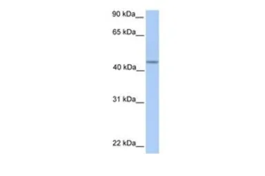 Anti-PNPLA5 antibody, C-term used in Western Blot (WB). GTX46144