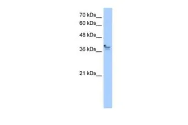 Anti-PCMTD1 antibody, Internal used in Western Blot (WB). GTX46149