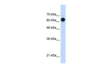 Anti-C3ORF39 antibody, Internal used in Western Blot (WB). GTX46151