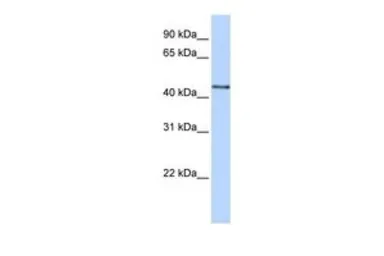 Anti-B3GNT4 antibody, N-term used in Western Blot (WB). GTX46158