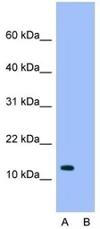 Anti-RPS16 antibody, N-term used in Western Blot (WB). GTX46159