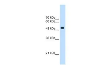 Anti-CXORF34 antibody, Internal used in Western Blot (WB). GTX46162