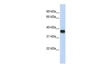 Anti-NUDT18 antibody, C-term used in Western Blot (WB). GTX46166