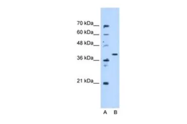 Anti-ECHDC3 antibody, N-term used in Western Blot (WB). GTX46168