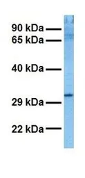 Anti-NMNAT1 antibody, N-term used in Western Blot (WB). GTX46173