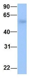 Anti-OXCT2 antibody, Internal used in Western Blot (WB). GTX46174