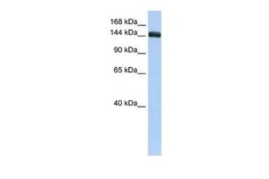 Anti-UGCGL2 antibody, Internal used in Western Blot (WB). GTX46178