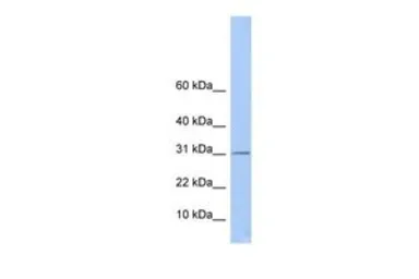 Anti-ECHDC1 antibody, Internal used in Western Blot (WB). GTX46182