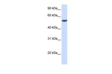 Anti-PHF10 antibody, Internal used in Western Blot (WB). GTX46183
