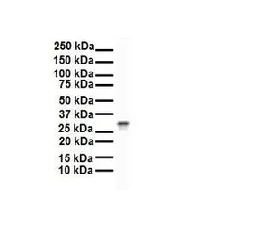 Anti-ECHDC2 antibody, Internal used in Western Blot (WB). GTX46184