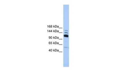Anti-POLR3B antibody, C-term used in Western Blot (WB). GTX46186