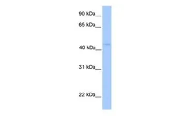 Anti-LIPT1 antibody, N-term used in Western Blot (WB). GTX46191