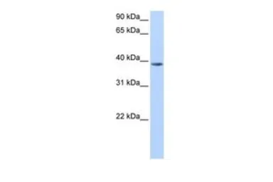 Anti-NUDT13 antibody, N-term used in Western Blot (WB). GTX46192