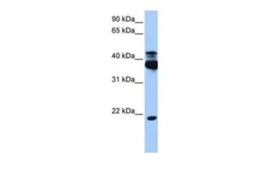 Anti-STK38 antibody, C-term used in Western Blot (WB). GTX46199