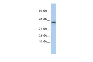 Anti-GLYAT antibody, N-term used in Western Blot (WB). GTX46205