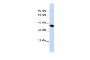 Anti-ST8SIA4 antibody, Internal used in Western Blot (WB). GTX46206