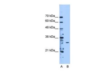 Anti-METTL1 antibody, Internal used in Western Blot (WB). GTX46207