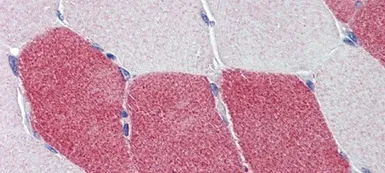 Anti-HMGCS1 antibody, Internal used in IHC (Paraffin sections) (IHC-P). GTX46215