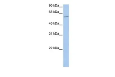 Anti-MBOAT1 antibody, N-term used in Western Blot (WB). GTX46217
